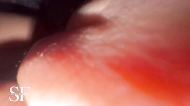 Succionador de cliptoris