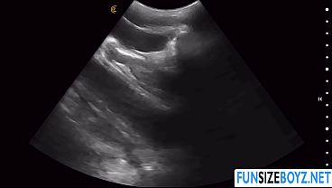 While having an ultrasound my doctor penetrates me