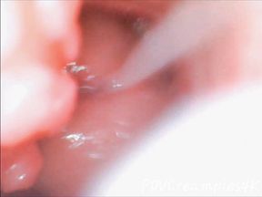 Endoscope Creampie. Cam Inside Pussy Shows Dick Cumming Inside Pussy