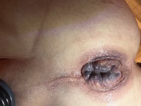 After Anal Pumping