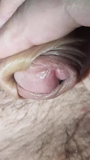 Foreskin play