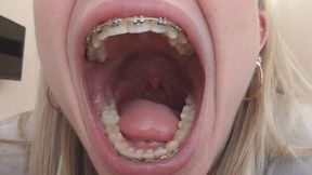 Yawning with a huge, wide mouth! MP4