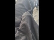 A few pearl implant pics