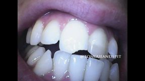 Aaron Teeth Endoscope Part17 Video1 - MP4