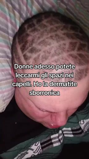 The tik tok master suffers from dermatitis
