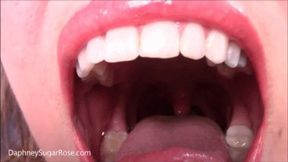 * 854x480p * A Little Pest Stuck in My Mouth -mp4