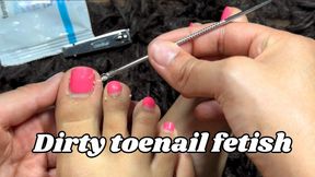 Long Dirty Toenails Trimmed After three Months