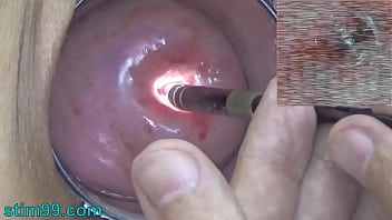 Crazy gyno exam: Wife's cervix and womb inspected on camera