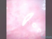 Camera inside Vagina after internal Creampie EP2 - ส่องกล้องในหีหลังแตกใน