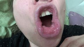 Morning bad breath and dirty tongue 2