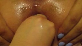 First-time Anal Fisting Results in Intense Rosebud Prolapse