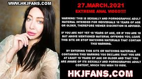 Hotkinkyjo with huge finger dildo from mrhankey anal &amp_ belly bulge