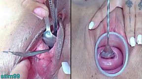 Milf Lesbians Cervix and Urethral Penetration