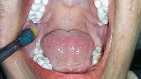 Mouth Examination Video for My Dentist