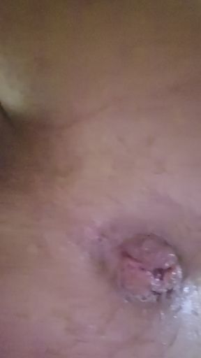 Hole after the game