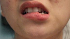 Aurora's Teeth Drive You Wild