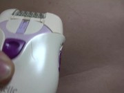 hair removal arround nipples