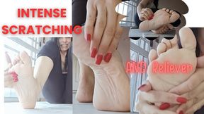 Intense and relieving foot scratching