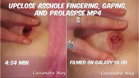 Upclose Anal Fingering Gaping &amp; Prolapse
