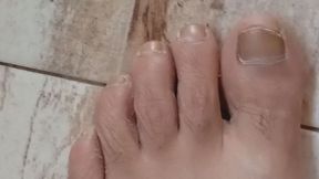 My defective feet