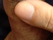 My penis dripping liquid