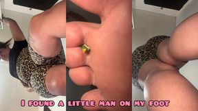 A little man on my foot and anus
