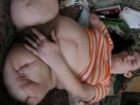 Triple Amputee BBW