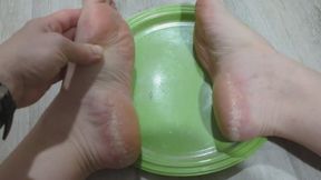 18-year-old flaky feet toenail dust crooked toe missing nail