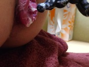 アナル吸引　アナルローズ拡張2