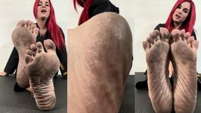 Big Dirty Karate Feet 1