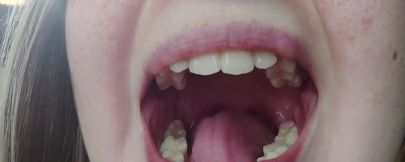 Throat Fetish