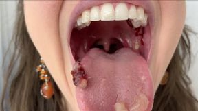 Chewing Grapes
