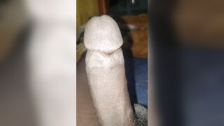 Humungous bone