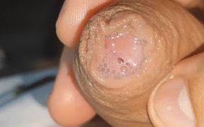 Curious Straight Has Huge Massive Explosion!