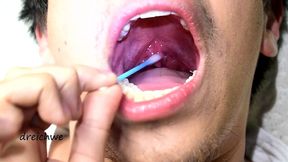 touching the uvula with swabs