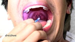 touching the uvula with swabs