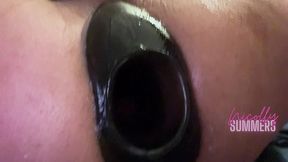 enlarged nipples and widened anal