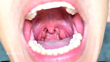 Uvula in the foreground - Collection 12