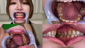 Yumeru Kotoishi - Watching Inside mouth of Japanese cute girl - MOV 1080p