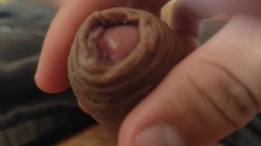 Great Phimosis Getting in the Way of the Boy's Orgasm