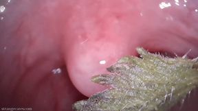 tongue and uvula stinging nettles (1080 wmv)