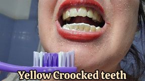 Brushing My Yellow Crooked Teeth After 7 Days: New Toothbrush & Mouthwash Gargle Close-Up