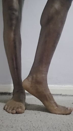 My feet need attention