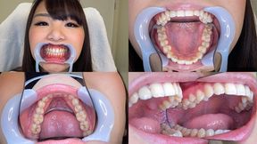 Kurumi - Watching Inside mouth of Japanese pretty girl BITE-45-1 - wmv