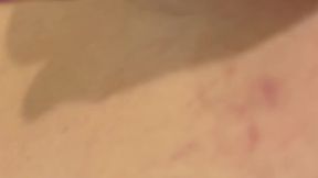 Anal Gape