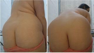 Balcony Buttrack View