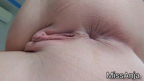 Tease