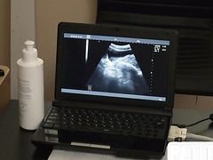 Petite twink fucked on ultrasound in voyeurs infirmary