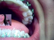 Lila jordan, Mini cam, vore fetish, endoscope