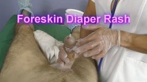 Foreskin Diaper Rash (2)